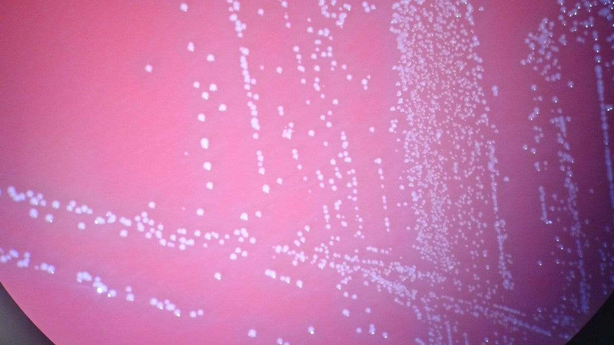 Small white bacterial colonies of Aerococcus urinae growing on a pink agar culture plate.
