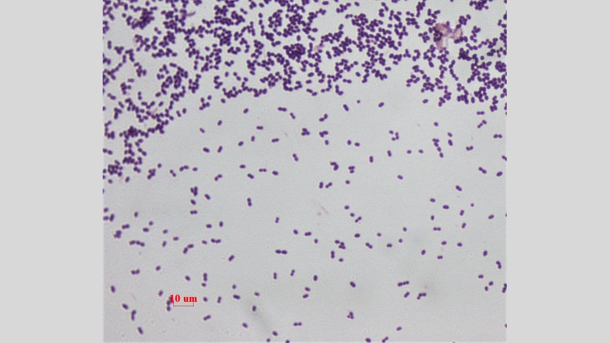 Oval purple bacteria in pairs and short chains scattered across a pale background in a stained light-microscope image, with a 10 micrometer scale bar.