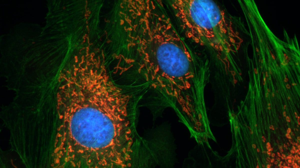 Fluorescence micrograph of cultured endothelial cells, showing green filament bundles, orange mitochondria and blue nuclei against a black background.