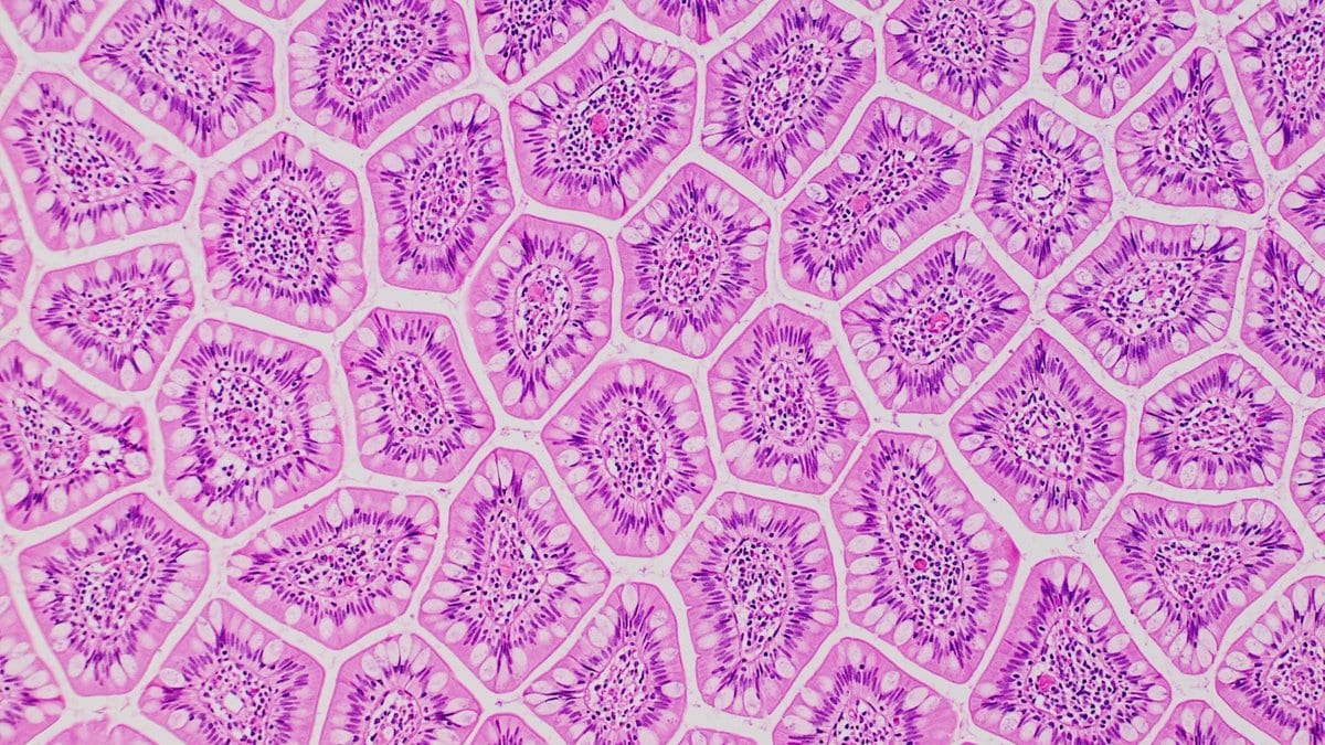 Microscope view of small intestinal villi in cross section, stained pink and purple and packed together like a honeycomb.