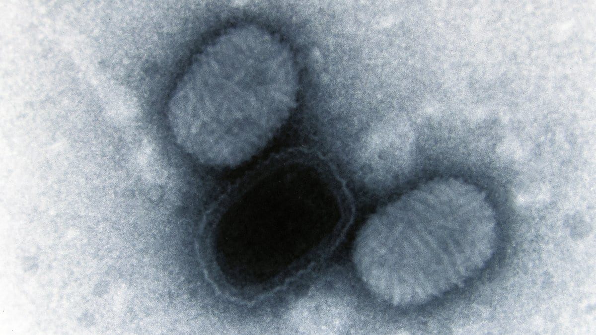 Transmission electron micrograph of three oval molluscum contagiosum virus particles against a pale, grainy background.