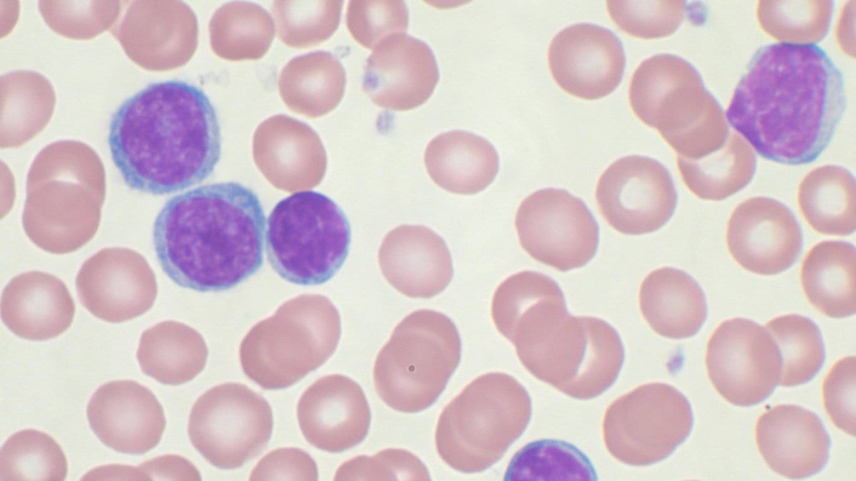 Stained blood film showing several small, dark purple lymphocytes among pale pink red blood cells.