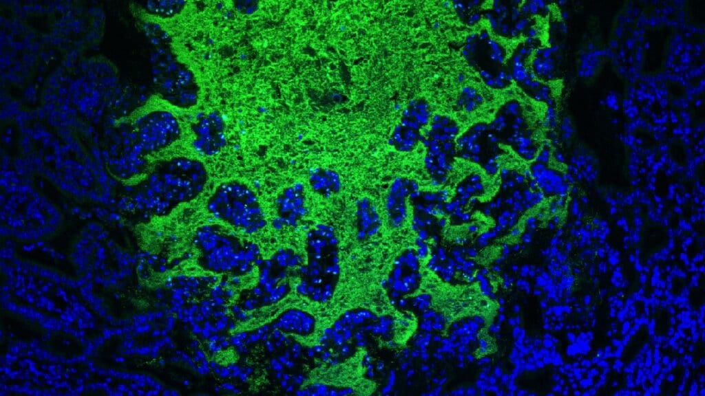 Fluorescence micrograph of green bacteria massed over blue-stained gut tissue.