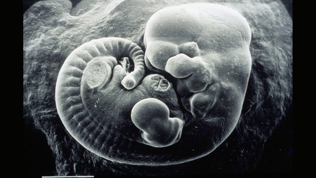 Scanning electron micrograph of a mouse embryo curled into a C shape, with limb buds, a row of somites along its back and branchial arches at the head.