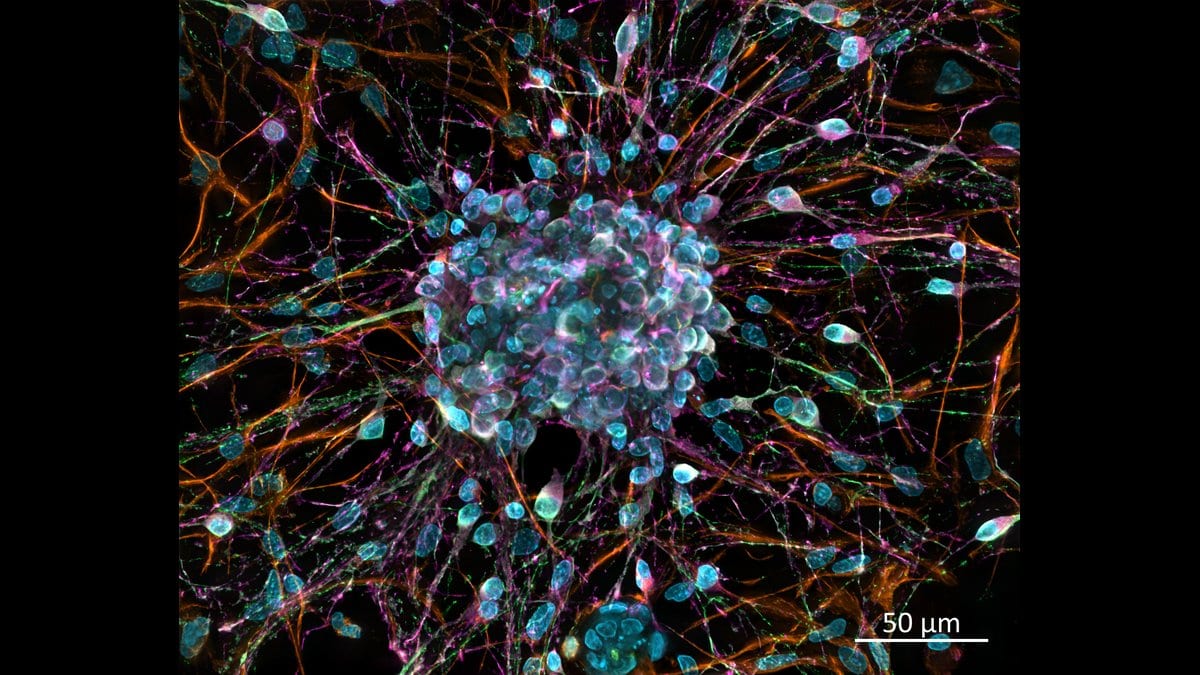 Fluorescence micrograph of rat cortical neurons grown in a dish, their branches labeled in orange, green and magenta against a black background, radiating from a dense central cluster of blue-stained nuclei.