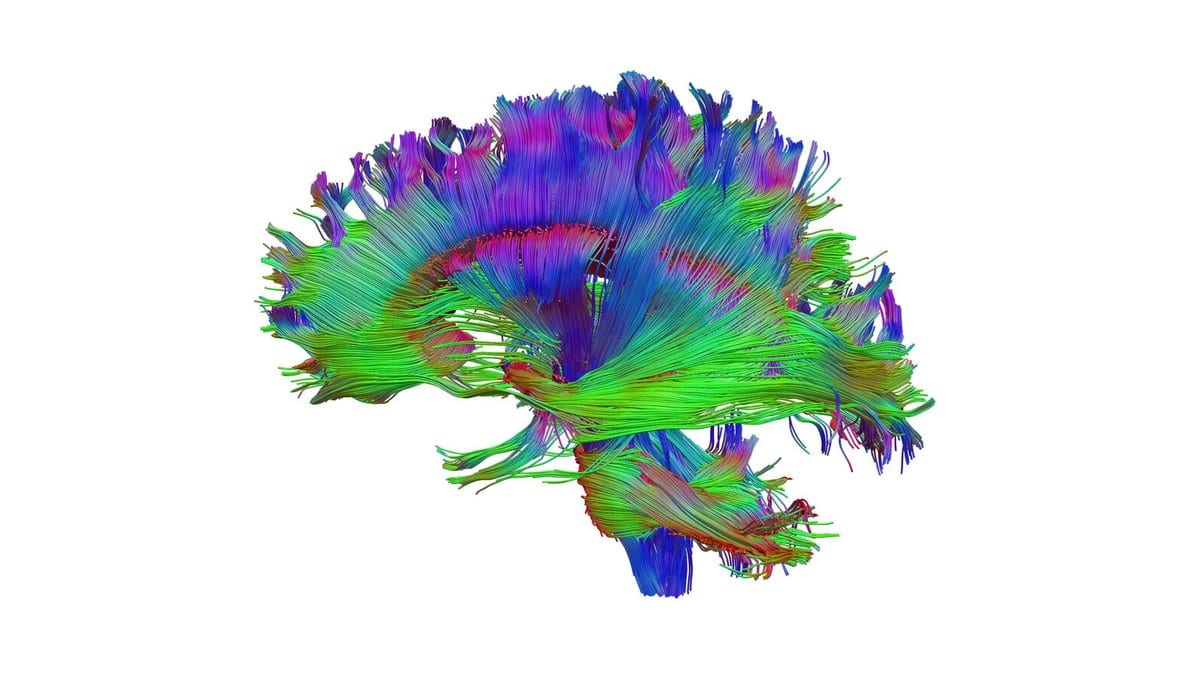 Computer rendering of white matter fiber bundles across a human brain, colored by the direction each bundle runs.