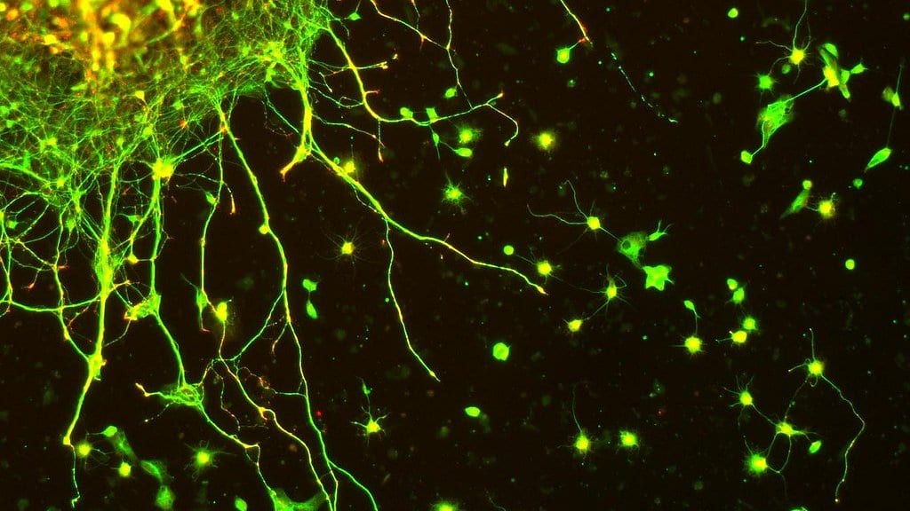 Fluorescence micrograph of neurons growing in culture, with glowing green cell bodies and long branching extensions against a dark background.