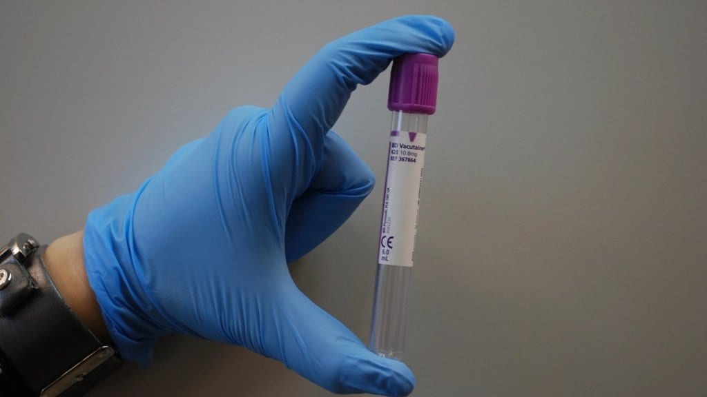 A gloved hand holding a capped vacuum blood collection tube against a plain gray background.