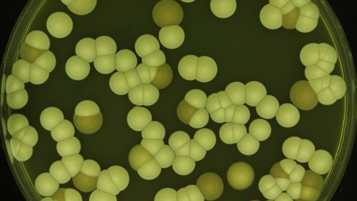 A petri dish crowded with pale yellow and tan Candida auris colonies on green agar.