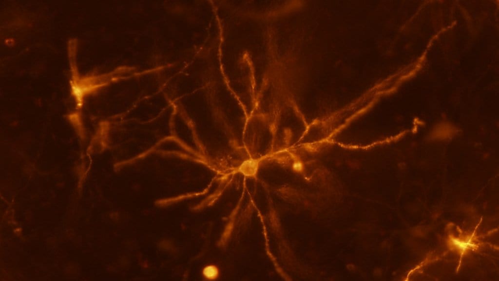 Fluorescence micrograph of a mouse neuron, its cell body bright at the center with thin branching processes spreading across a dark orange field.