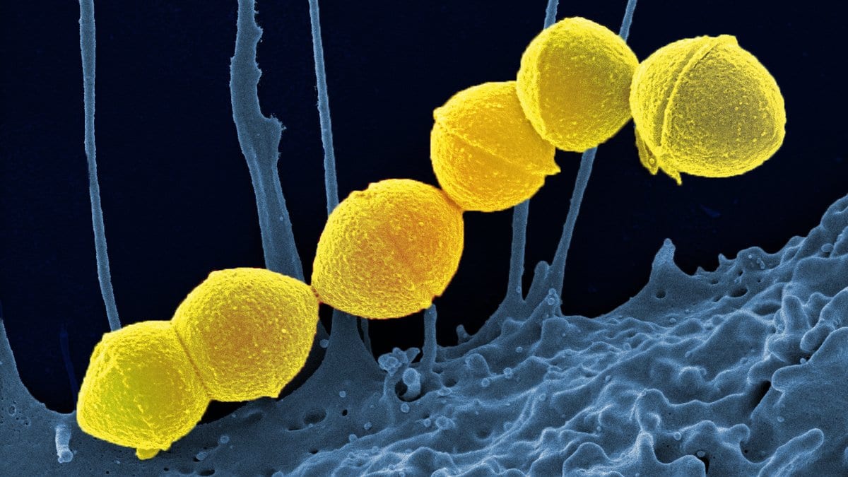 Colorized scanning electron micrograph of a chain of round yellow bacteria lying on the folded blue surface of a human white blood cell.