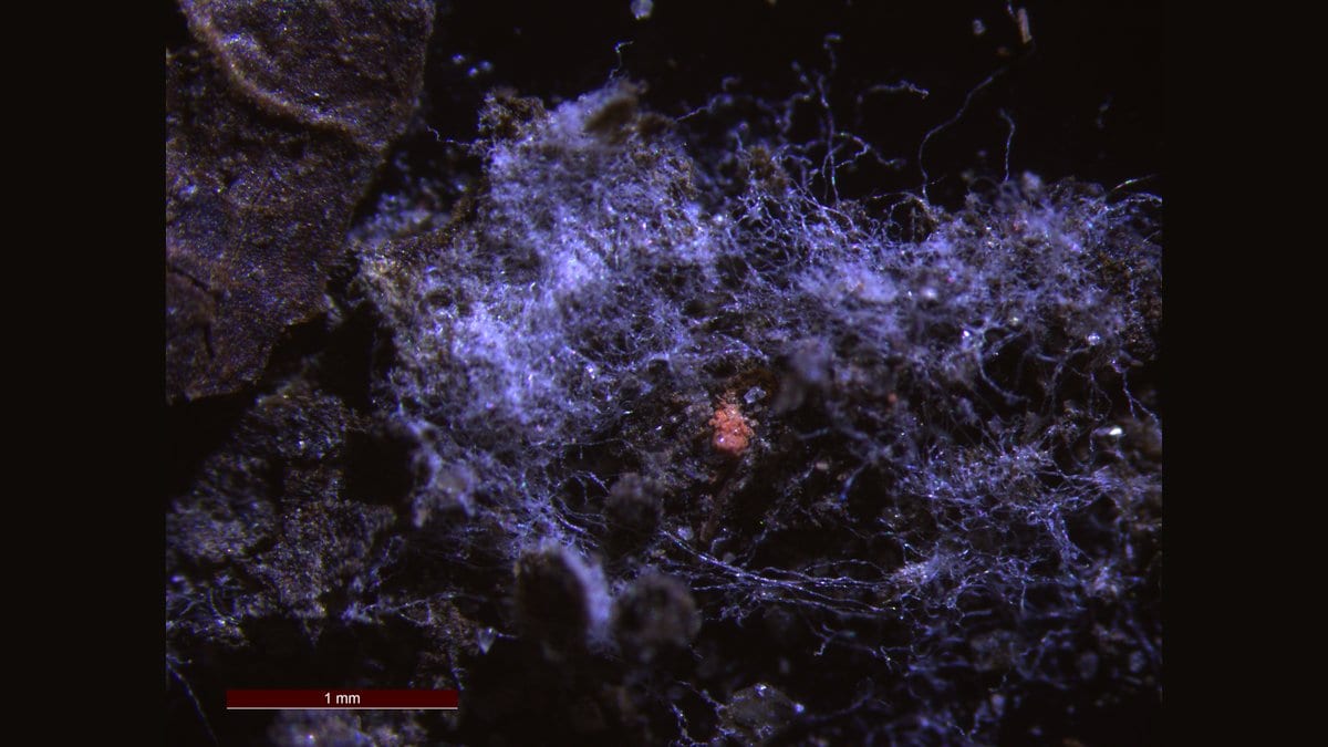 A dense tangle of pale plastic fibers photographed through a microscope against a dark background, with a scale bar at lower left.