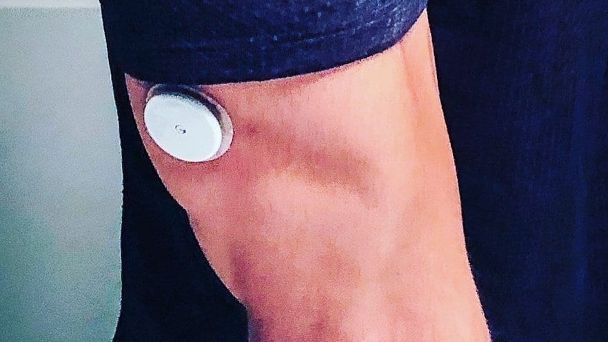 A small round glucose sensor taped to the back of a person's upper arm, just below a shirt sleeve.