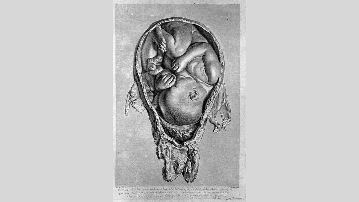 An engraving of a full-term fetus curled inside an opened human uterus, seen from the front.
