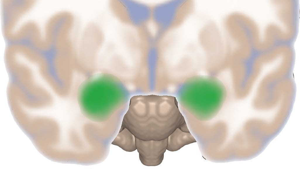 A coronal section through a human brain with both amygdalae highlighted in green, one deep in each temporal lobe.