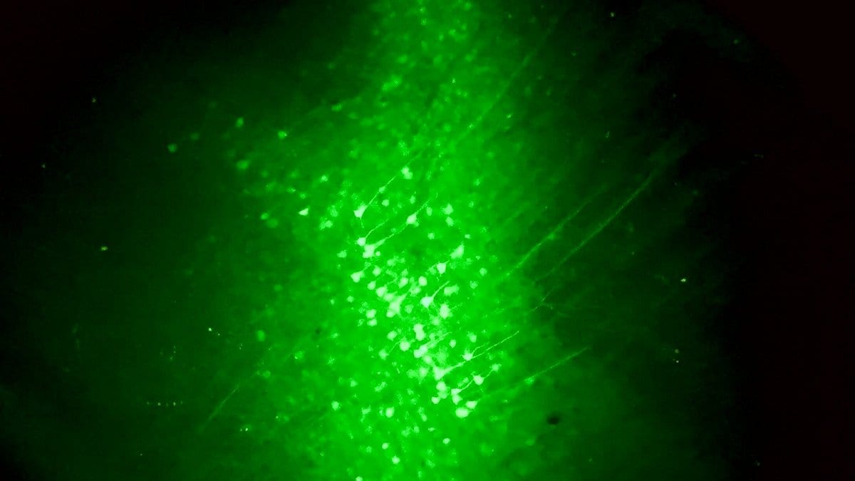 A dense cluster of nerve cells glowing bright green under a fluorescence microscope, their branching fibers spreading into darker surrounding tissue.