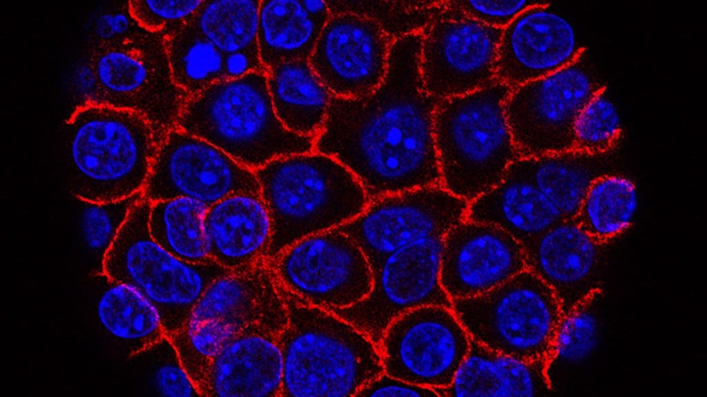 Fluorescence microscope image of a round cluster of pancreatic cancer cells, blue nuclei outlined by red cell membranes against a black background.