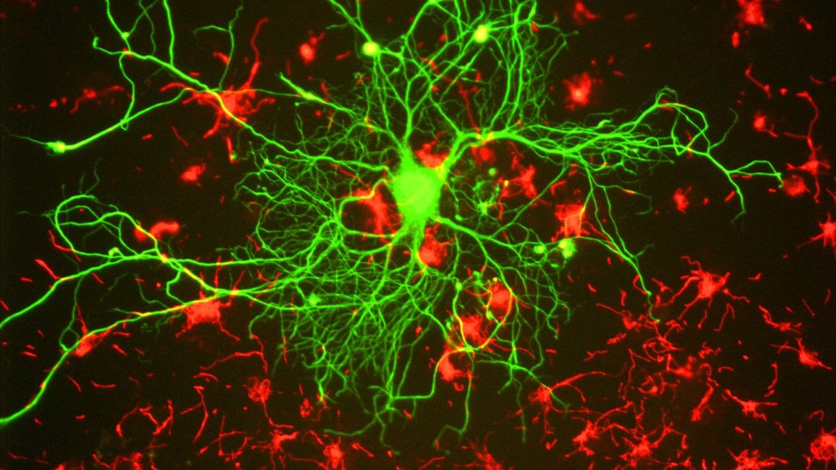 Fluorescence micrograph of a single cortical neuron stained green among glial cells stained red.