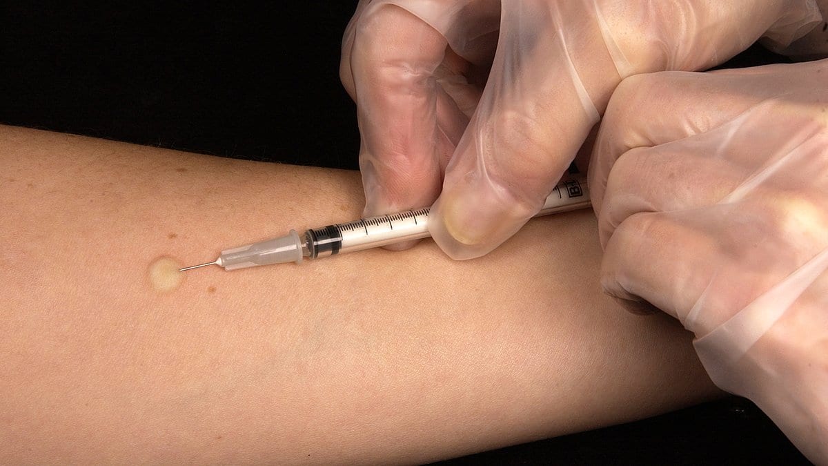 A gloved hand holds a fine syringe almost flat against the skin of a forearm, with a small raised bleb in the skin beside the needle.