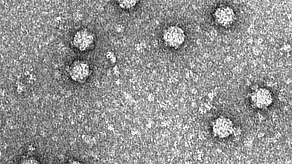 Transmission electron micrograph showing about ten rounded virus particles scattered across a grainy gray field.