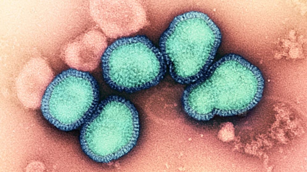 Transmission electron microscope image of influenza A virus particles