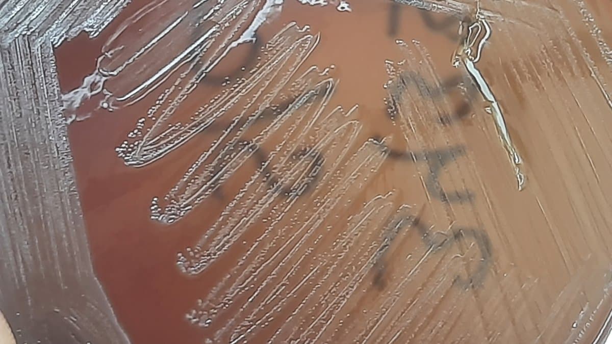 Vancomycin-resistant Enterococcus faecium colonies growing on a blood agar plate