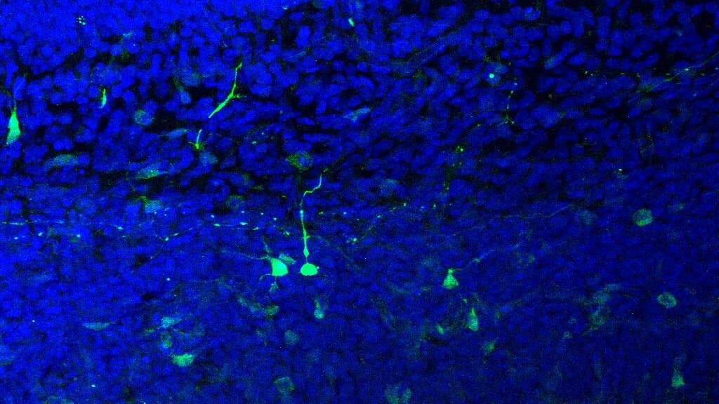 A fluorescence microscopy image of brain tissue with labelled neurons glowing green and blue.