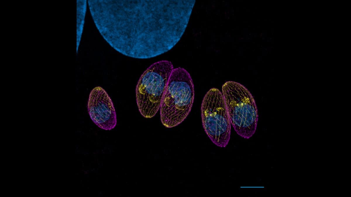 Fluorescence micrograph on a black background showing five oval Toxoplasma parasites outlined in magenta with blue interiors and yellow spots, below a large blue host-cell nucleus.