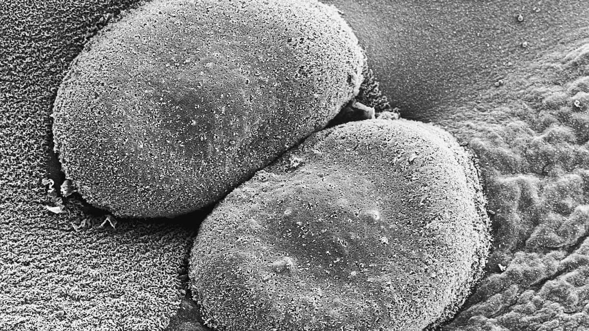 Scanning electron micrograph of two rounded Streptococcus pneumoniae cells lying together as a diplococcus pair, their surfaces finely textured, filling the frame.