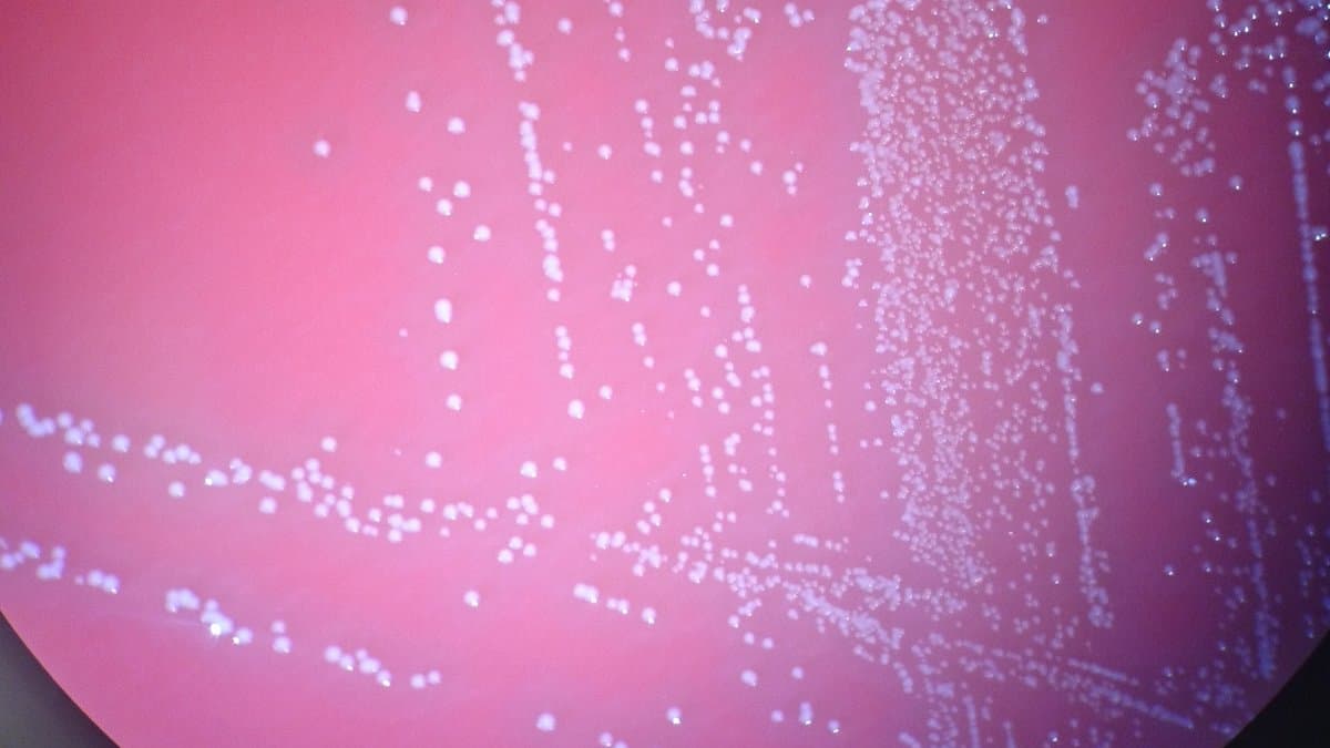 Small white bacterial colonies of Aerococcus urinae growing on a pink agar culture plate.